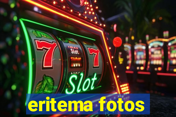 eritema fotos